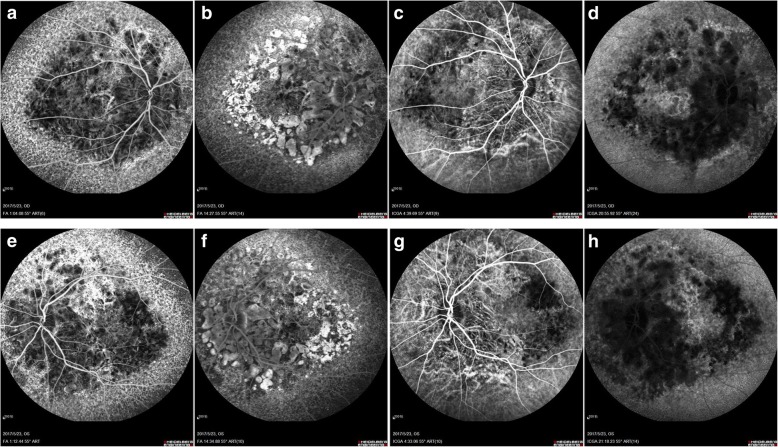 Fig. 4