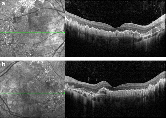 Fig. 3