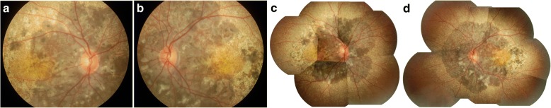 Fig. 1