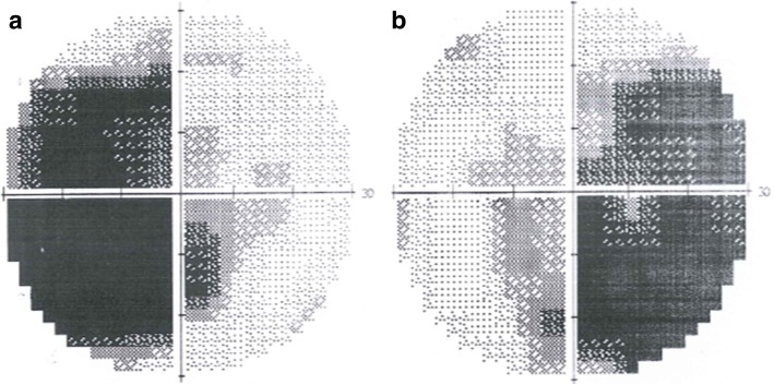 Fig. 5