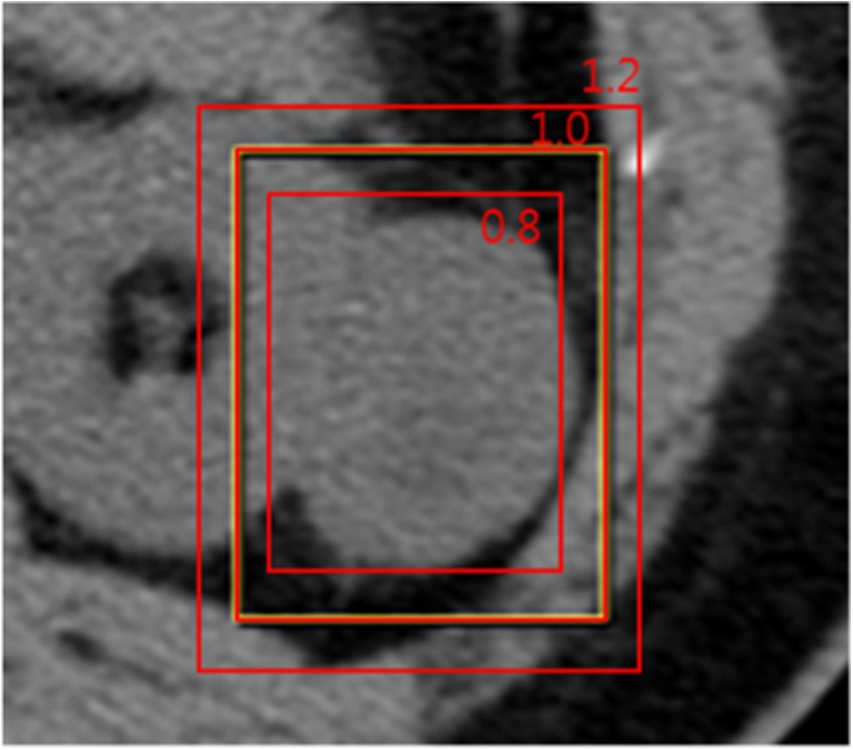 Fig. 2