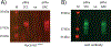 Fig 3)