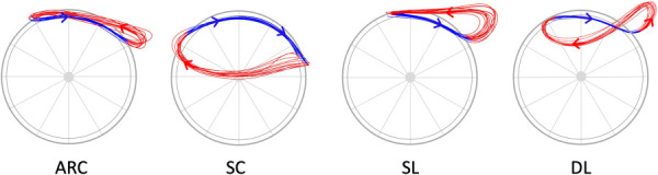 Four commonly used hand patterns: arcing (ARC), semicircular (SC), single-loop (SL), and double-loop (DL) observed during manual wheelchair propulsion. Arrows represent the direction of the hand’s motion during the push and recovery phases.