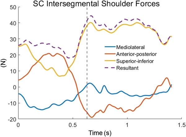 Shoulder joint intersegmental forces determined using inverse dynamics for the semicircular (SC) pattern. Dashed vertical line indicates the end of the push phase.