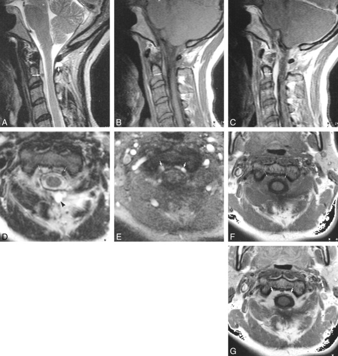 fig 3.