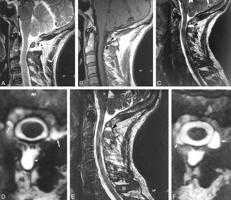 fig 1.