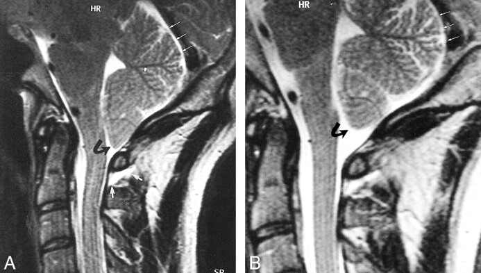 fig 2.