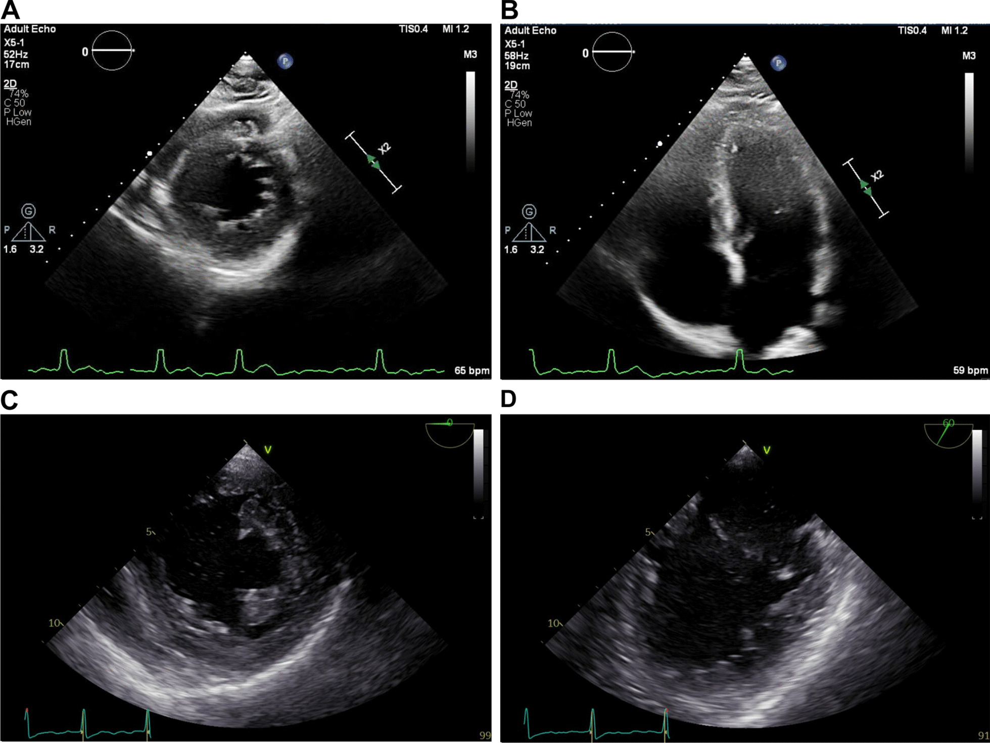 Fig. 2