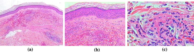 Fig. 2