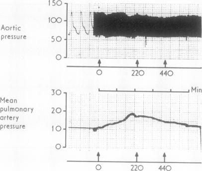 graphic file with name thorax00137-0054-a.jpg