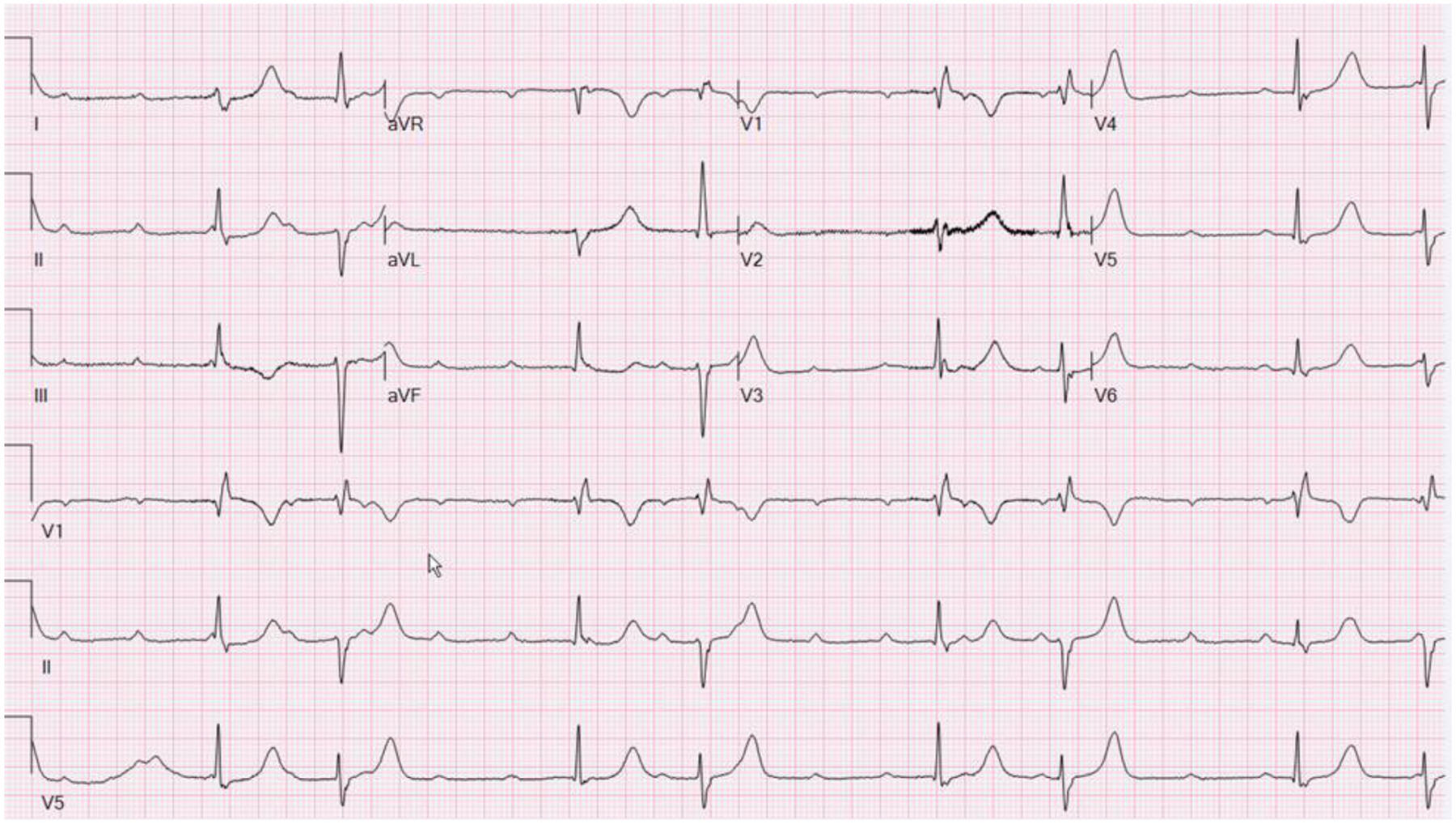 Figure 5: