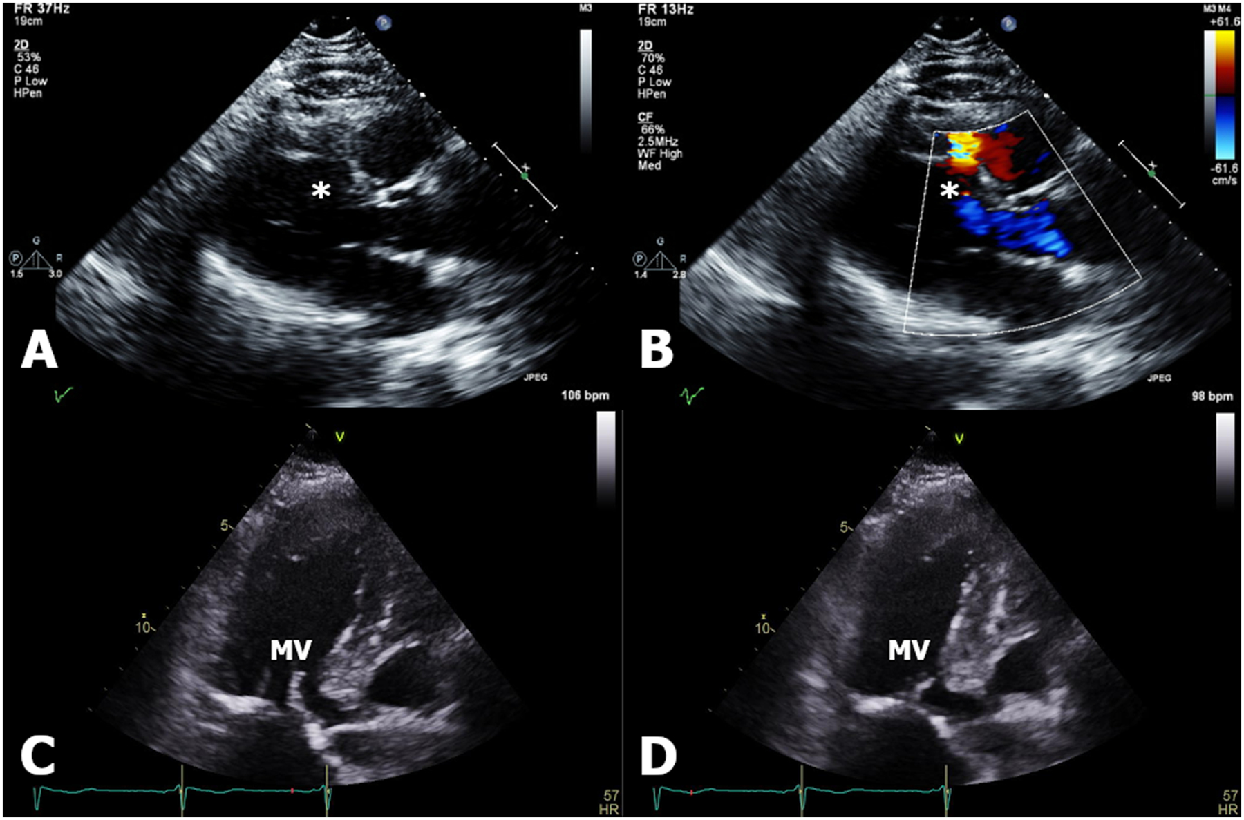 Figure 2: