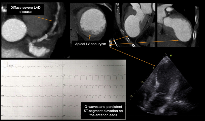 Figure 2