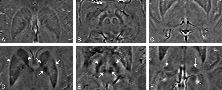 Fig 1.