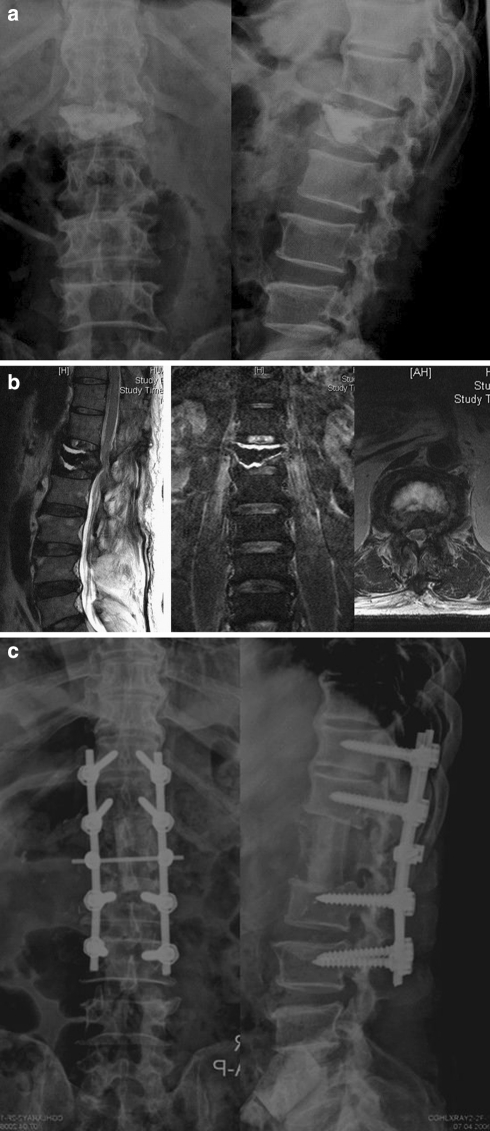 Fig. 3