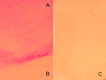 Figure 11.