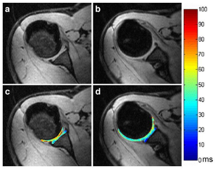 Fig. 12