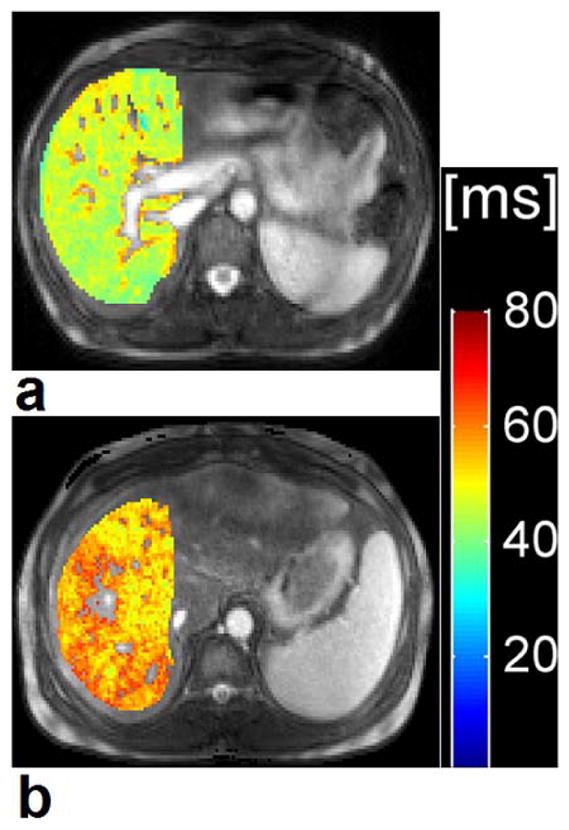 Fig. 14