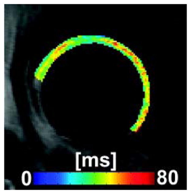 Fig. 11