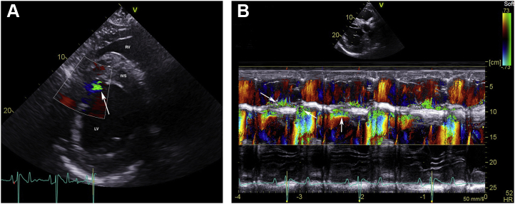 Figure 4