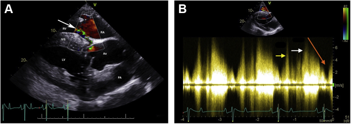 Figure 3