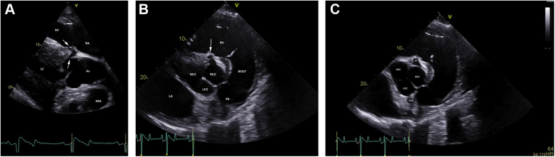 Figure 1