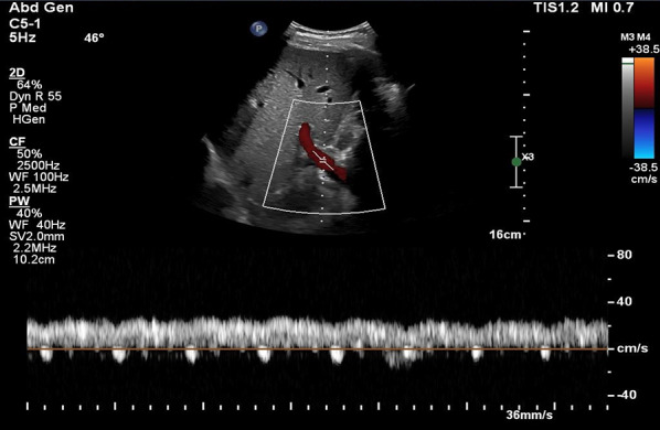 Fig. 21