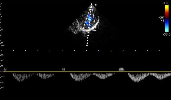 Fig. 11