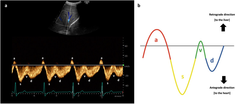 Fig. 12