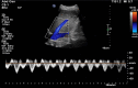 Fig. 10