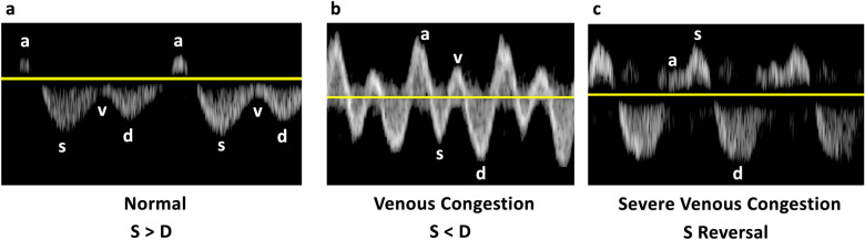 Fig. 17