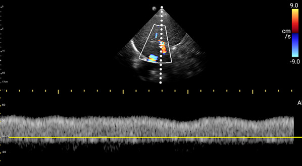 Fig. 23