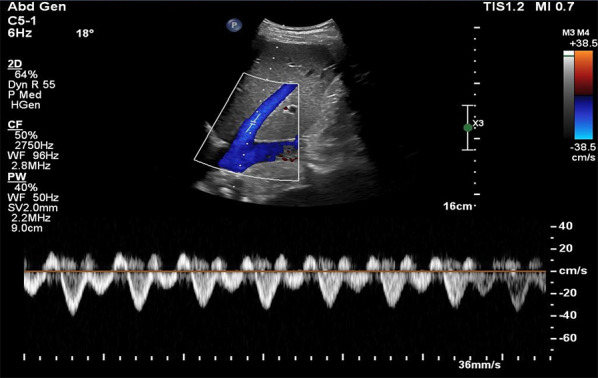 Fig. 10