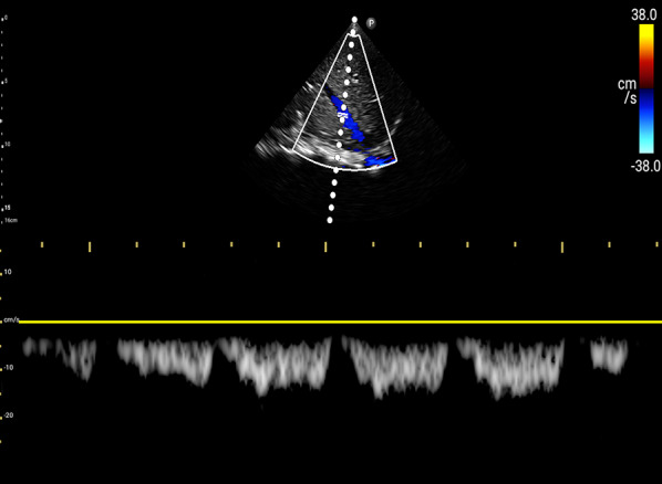 Fig. 19