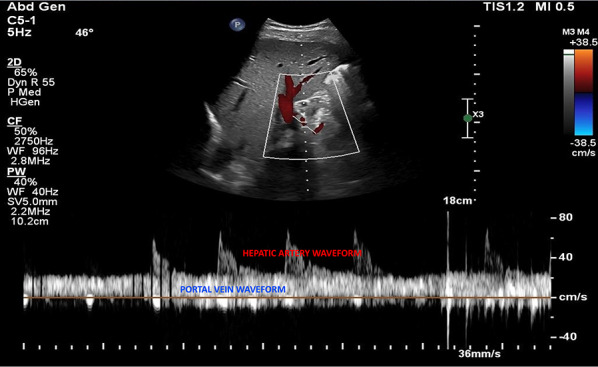 Fig. 22