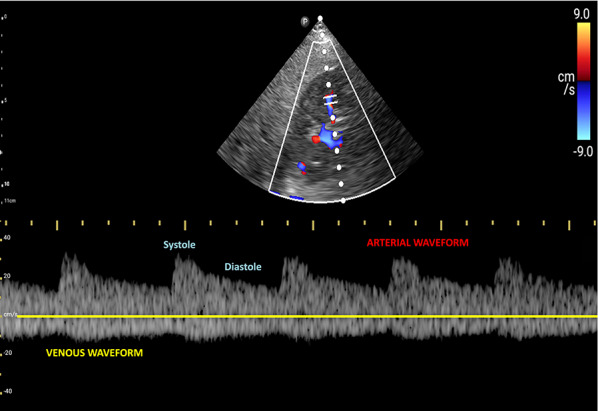 Fig. 29