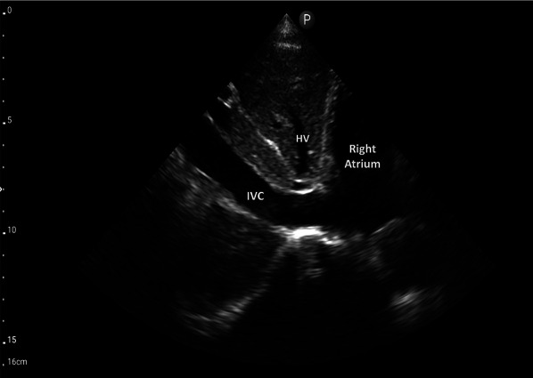 Fig. 4