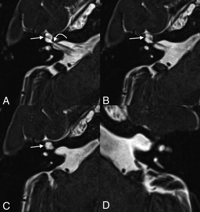 Fig 1.