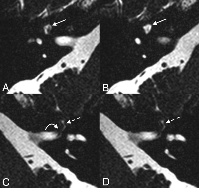 Fig 3.