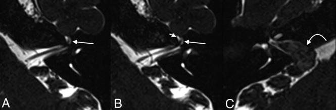 Fig 2.