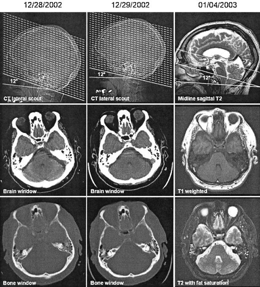 Fig 3.