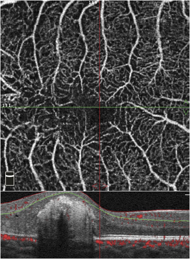 Fig. 1.