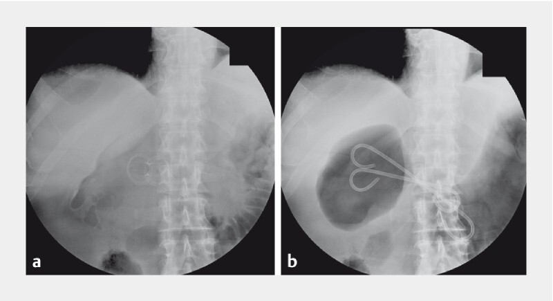 Fig. 2 a, b