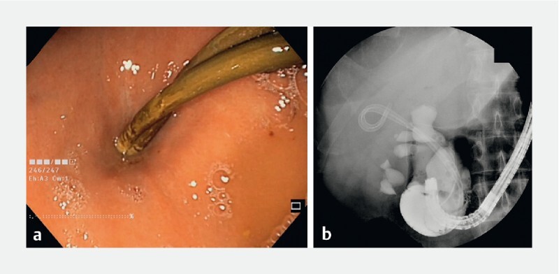 Fig. 3 a