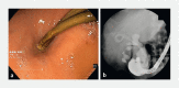 Fig. 3 a