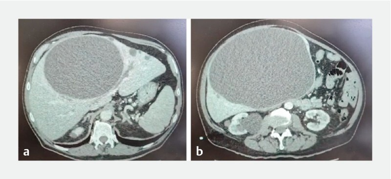 Fig. 1 a, b