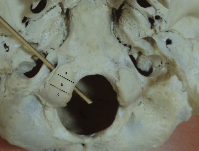 Fig. 3