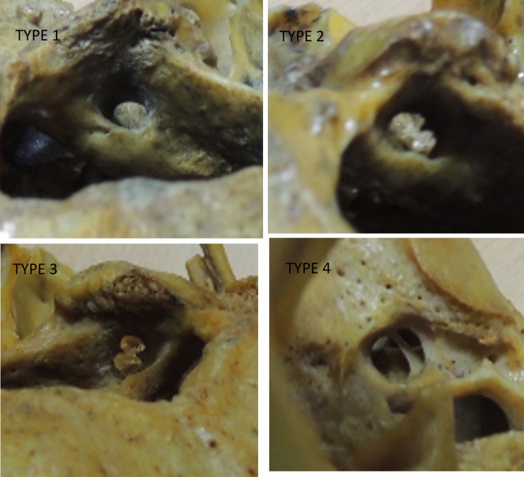 Fig. 4