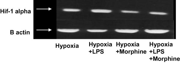 Figure 3B