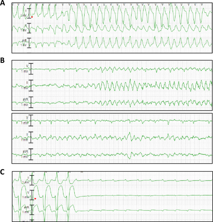 Fig 2